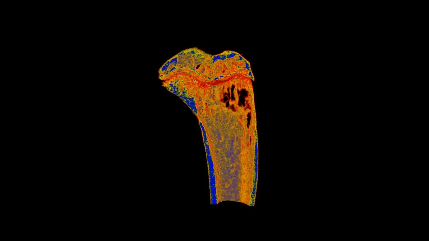 Thumbnail for Bone and joint | Medicine and Population Health 