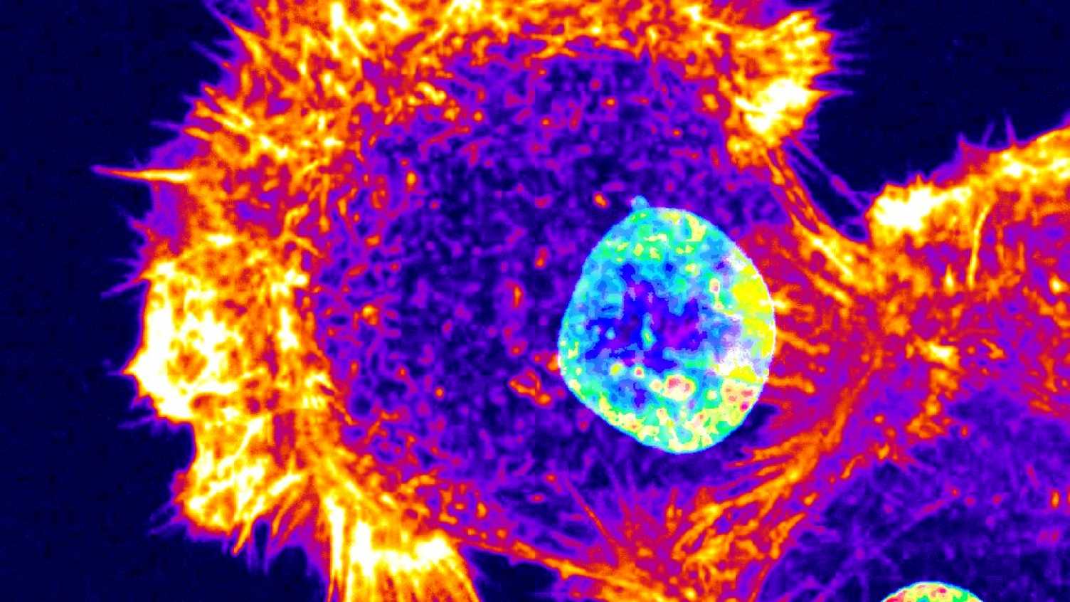 Thumbnail for Wolfson Foundation grant supports biological cell imaging at Sheffield | Alumni 