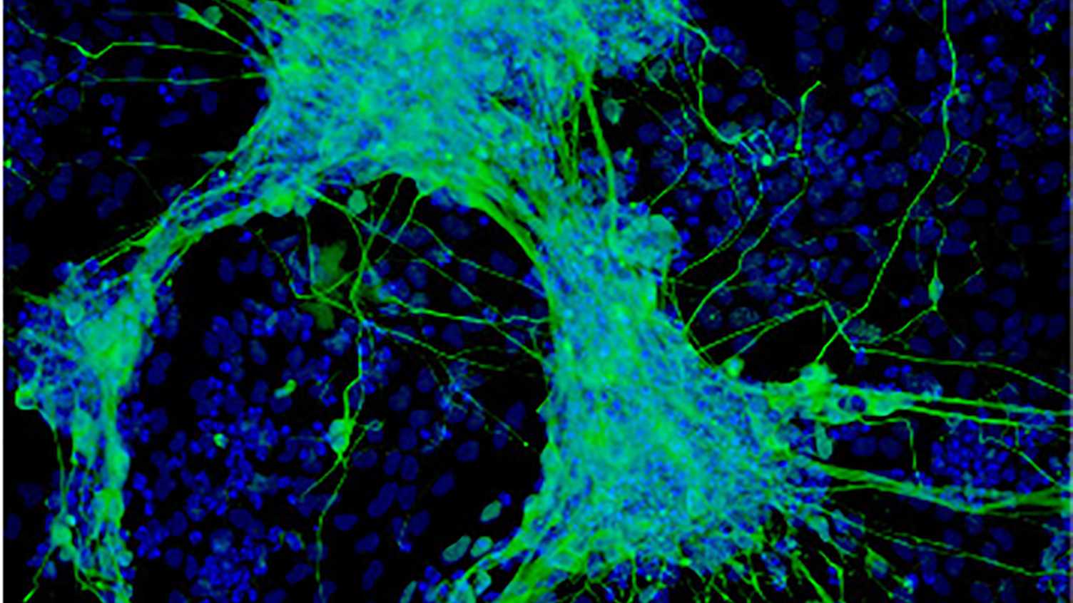 Thumbnail for Connecting Neural Networks: Nervous-System-on-Chip Technology | CSCB 