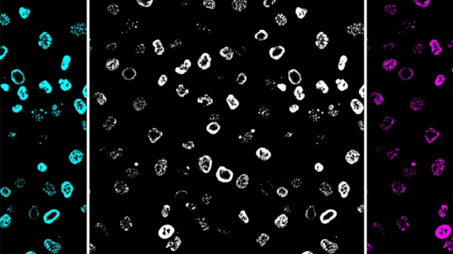 Thumbnail for Typhoid toxin accelerates cell ageing to enhance killer infection, study reveals…
