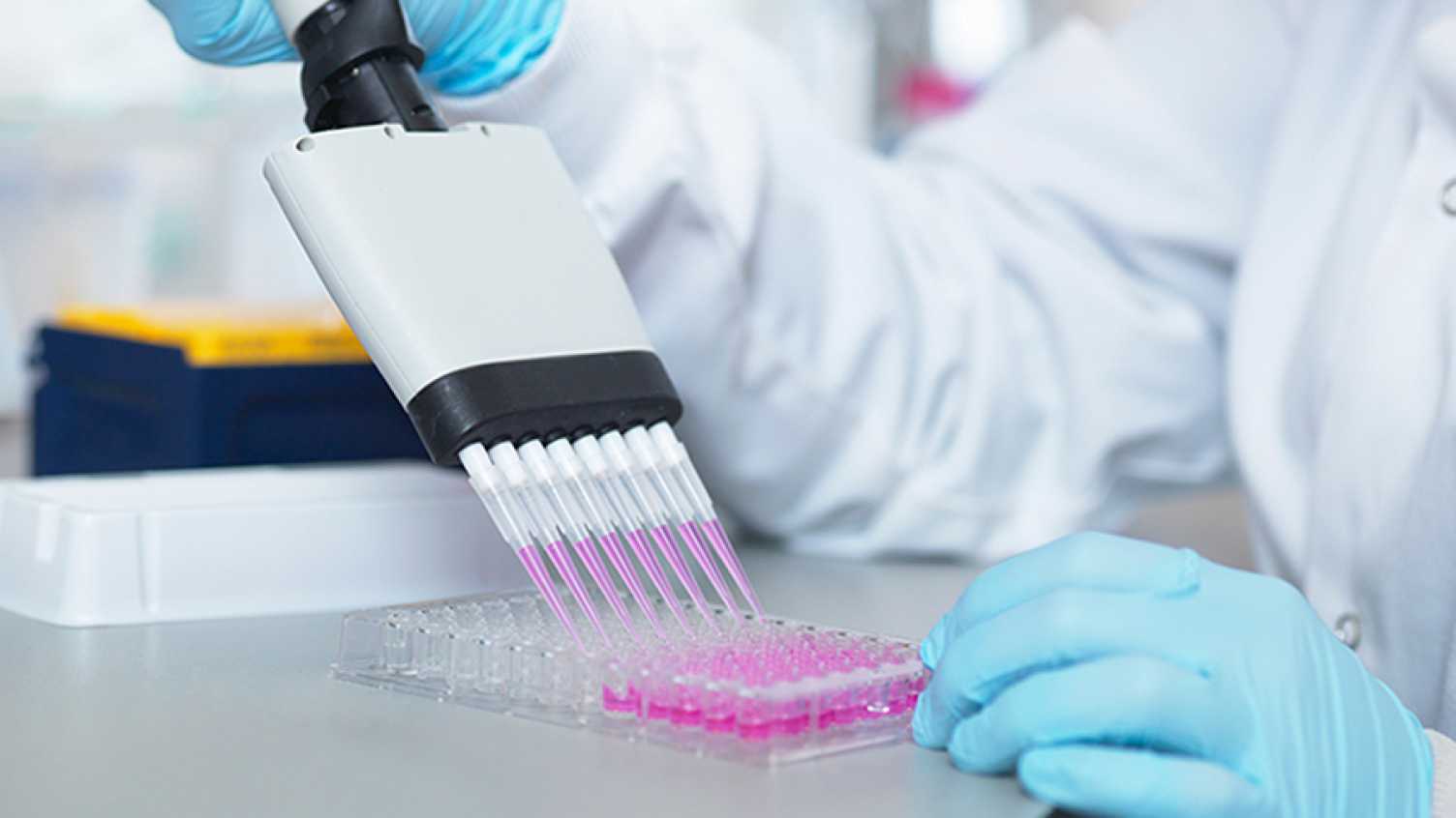 Thumbnail for Scientists collaborate to understand antibody responses in Covid-19 | Bioscience…