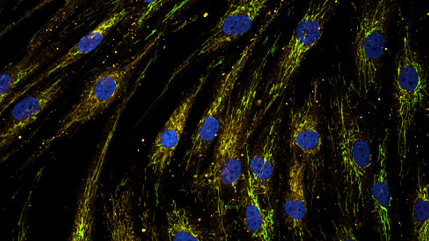 Thumbnail for World Alzheimer’s Month - PhD research investigates mitochondrial function in …