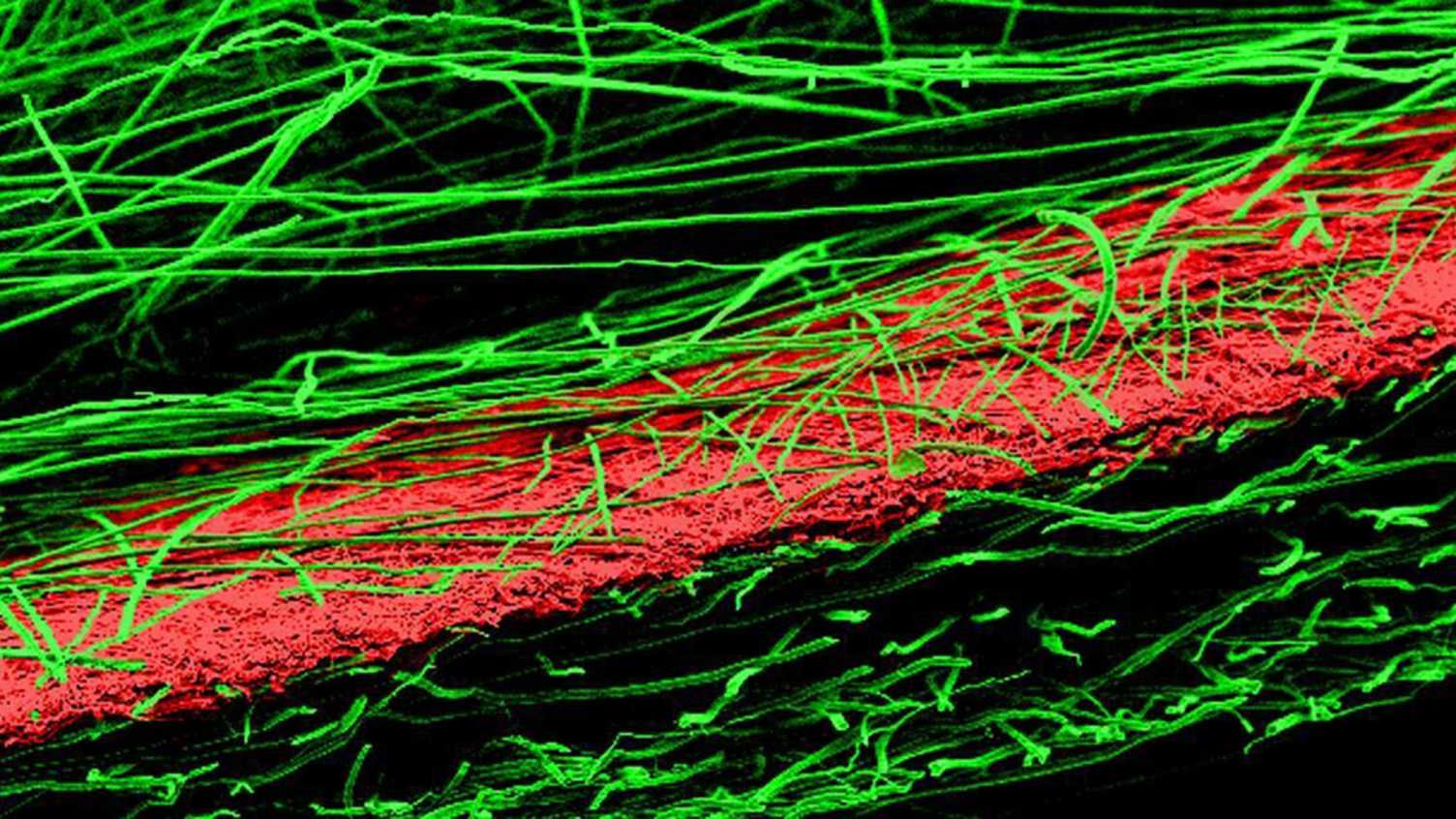 Thumbnail for Confocal imaging | CMBE 
