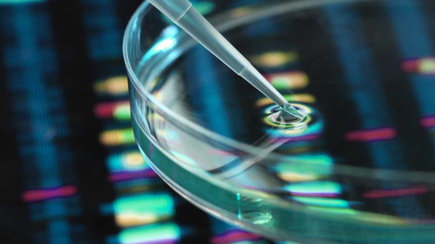 Thumbnail for University of Sheffield and Pfizer lead new €25.5 million project to accelerat…