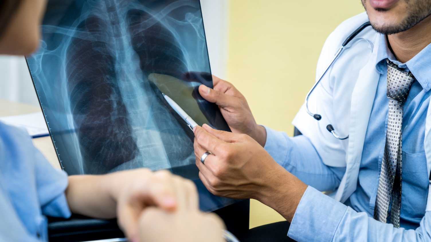 Thumbnail for Hidden damage to lungs from Covid-19 revealed in new study from University of Sh…