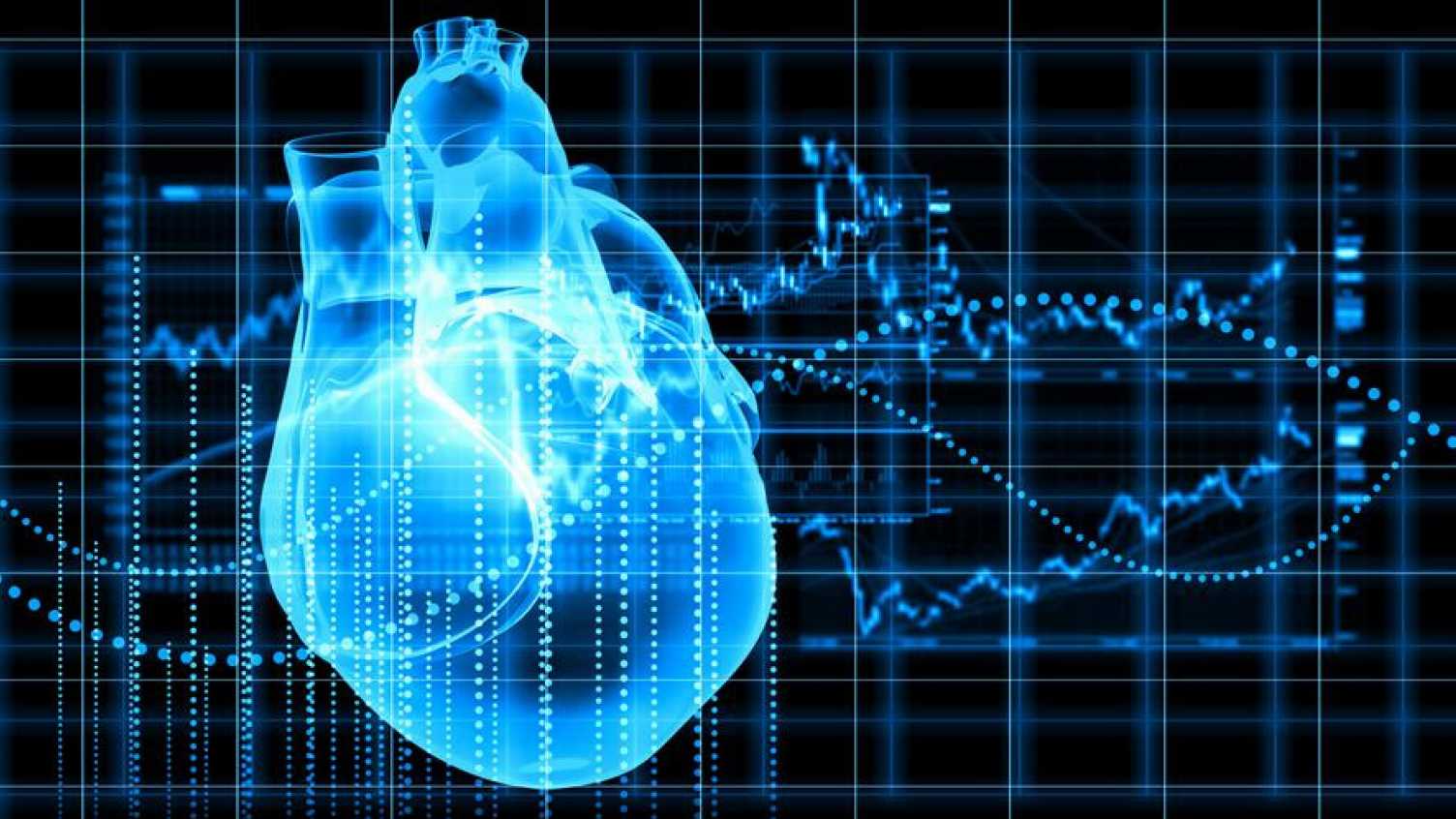 Thumbnail for NIHR NHSX grant to develop AI tools to measure heart health using MRI/CT scans |…