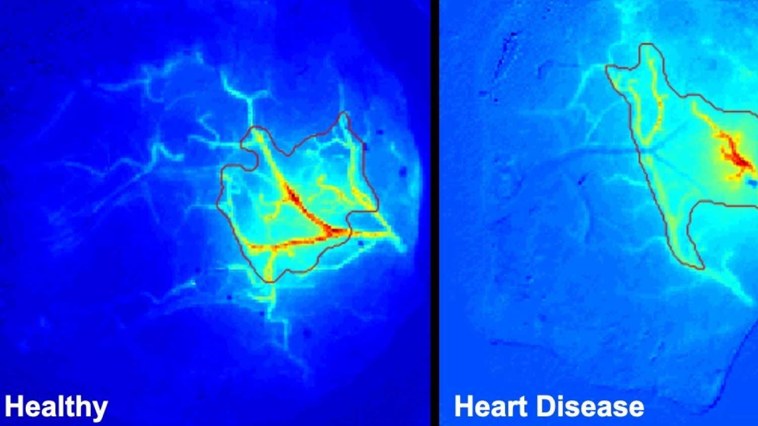 Thumbnail for Arthritis drug to be investigated as possible treatment for vascular dementia | …