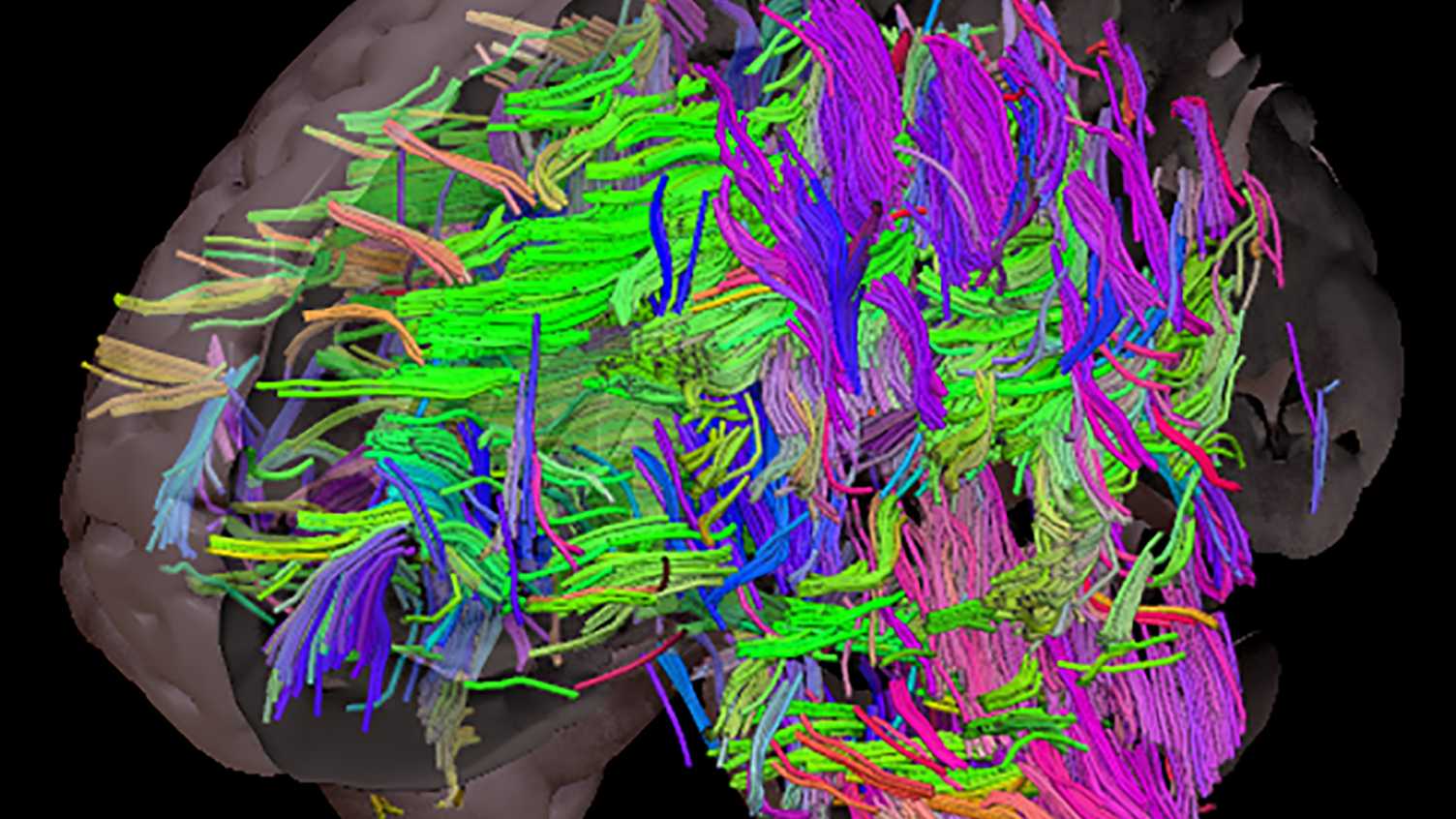 Thumbnail for Obesity may exacerbate the effects of Alzheimer’s disease, new study shows | N…
