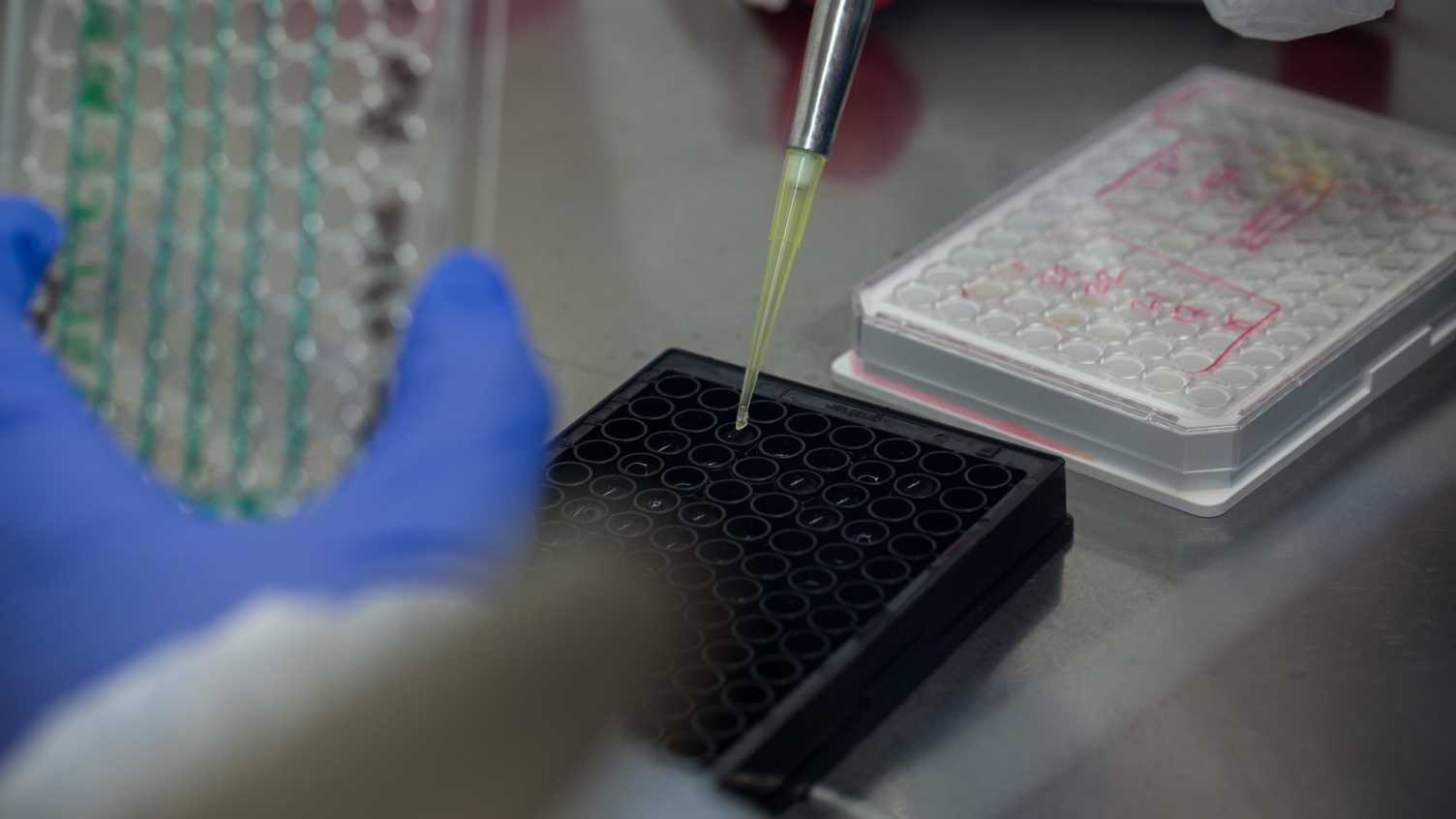 Thumbnail for Rare Disease Day 2023 – research at the Neuroscience Institute | Neuroscience …