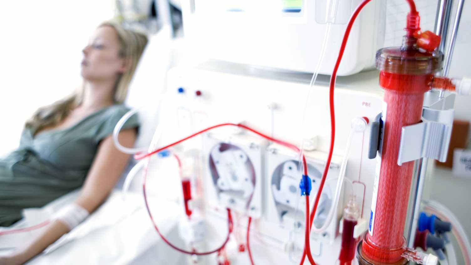 Thumbnail for £1.1m research to improve uptake of home kidney dialysis treatments | News 