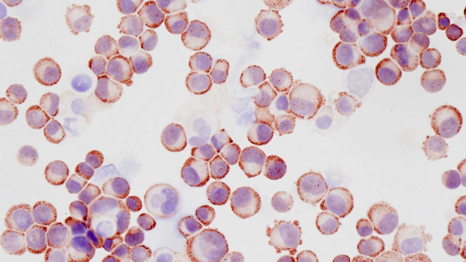 Thumbnail for Oral and head and neck cancers | Clinical Dentistry 