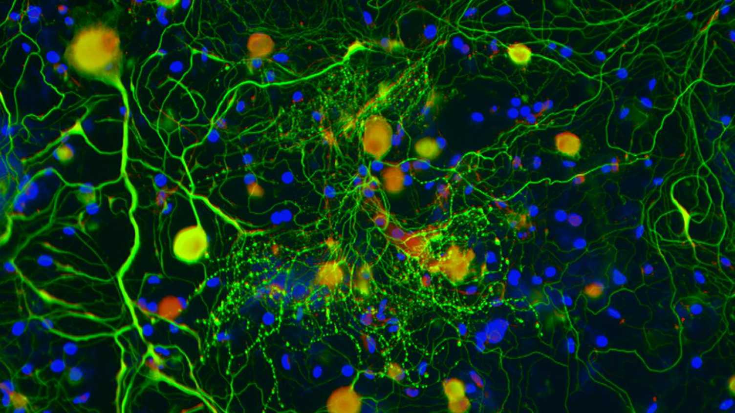 Thumbnail for Neuroscience | Clinical Dentistry 