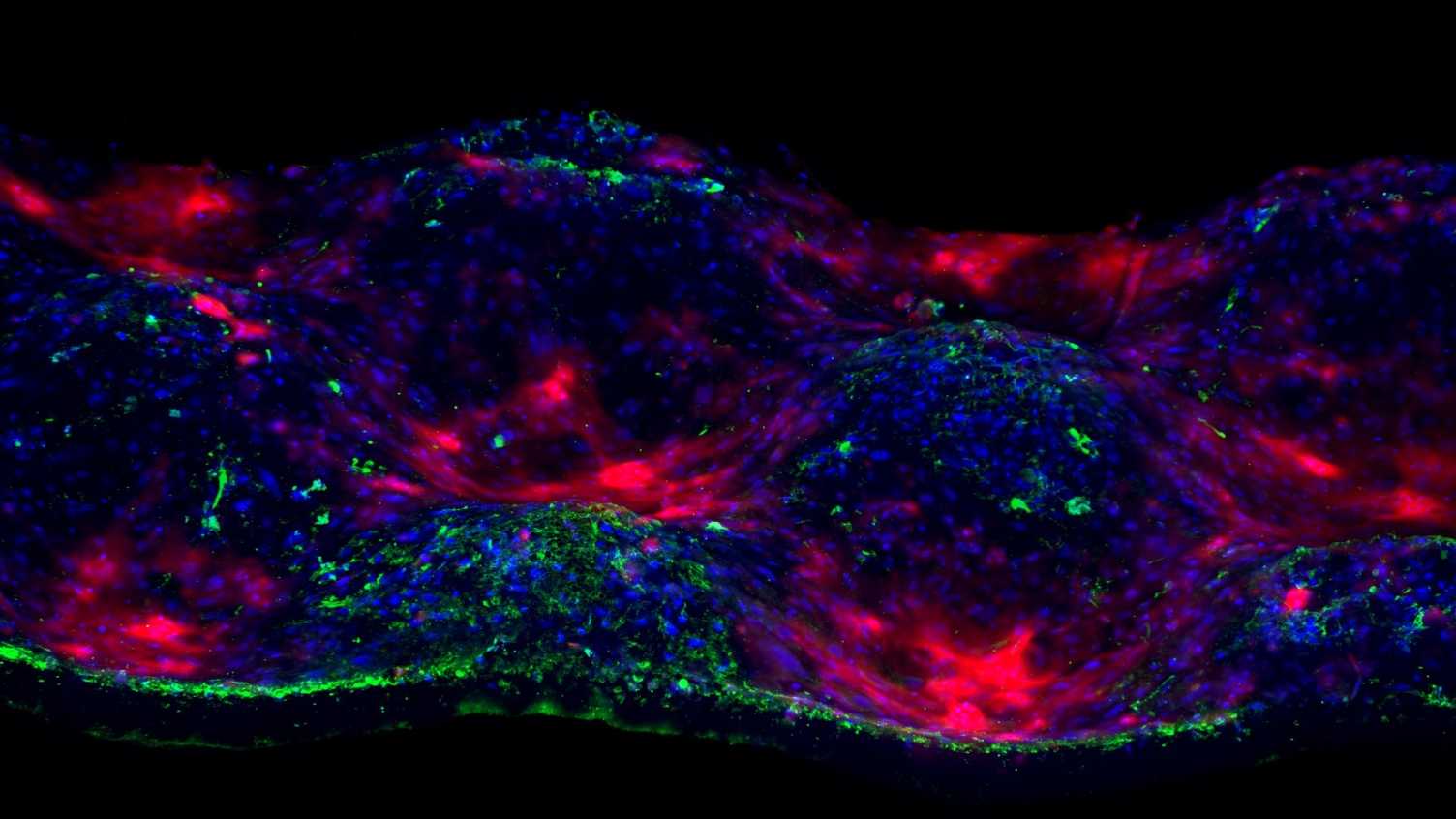 Thumbnail for Regenerative biomaterials & tissue engineering | Clinical Dentistry 