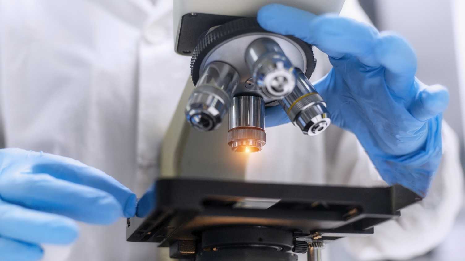Thumbnail for Sheffield researchers use pioneering technology to exploit DNA repair in brain t…