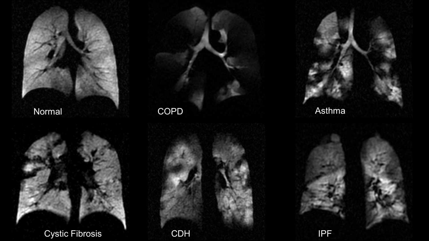Thumbnail for Pulmonary imaging | Medicine and Population Health 