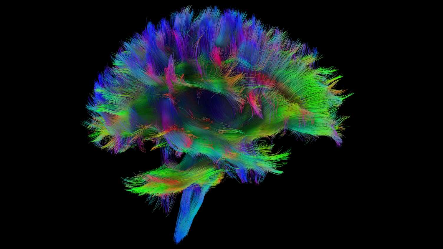 Thumbnail for Brain imaging | Medicine and Population Health 