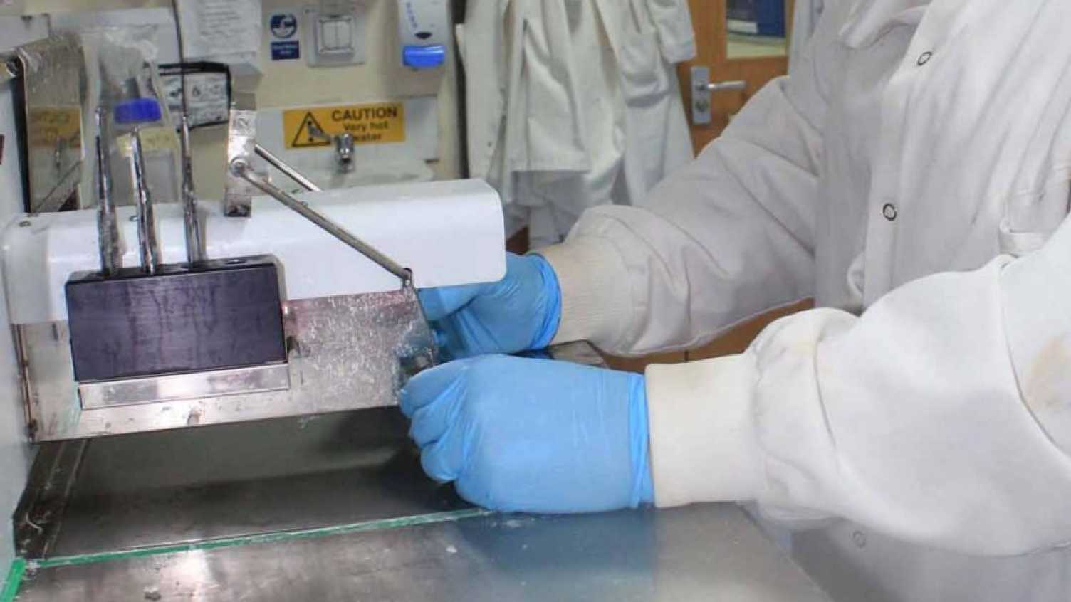 Thumbnail for About Skeletal Analysis Laboratories | Skeletal Analysis 