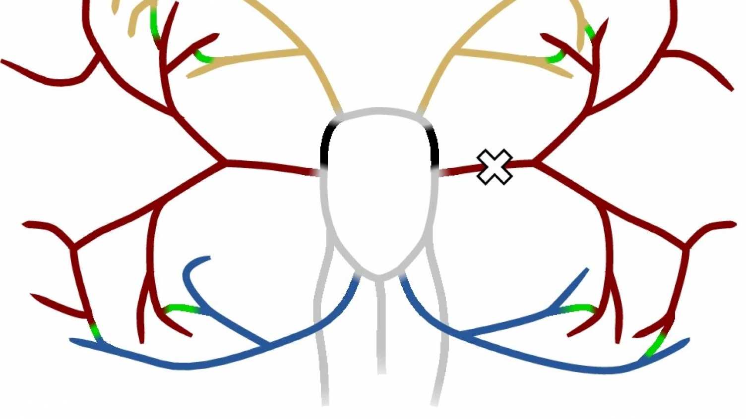 Thumbnail for Publication Cover Art on the cover of Annals of Biomedical Engineering June 2022…