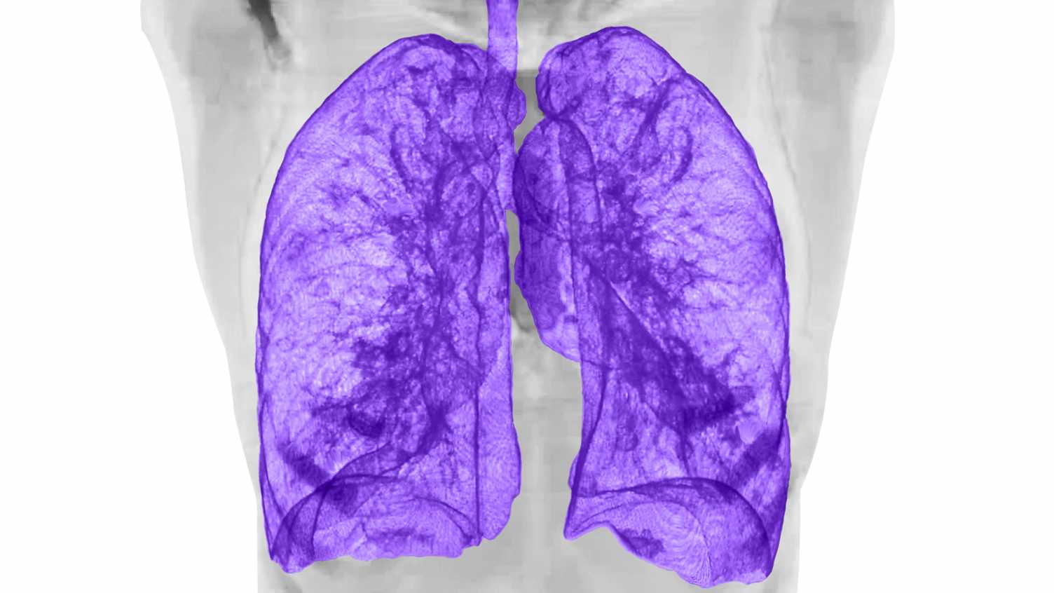 Thumbnail for Pioneering detailed lung MRI scans without radiation | Research 