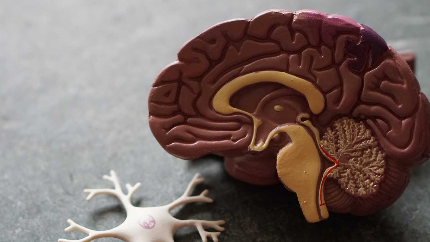 Thumbnail for Reimagining Dementias as Environmental Diseases | iHuman 