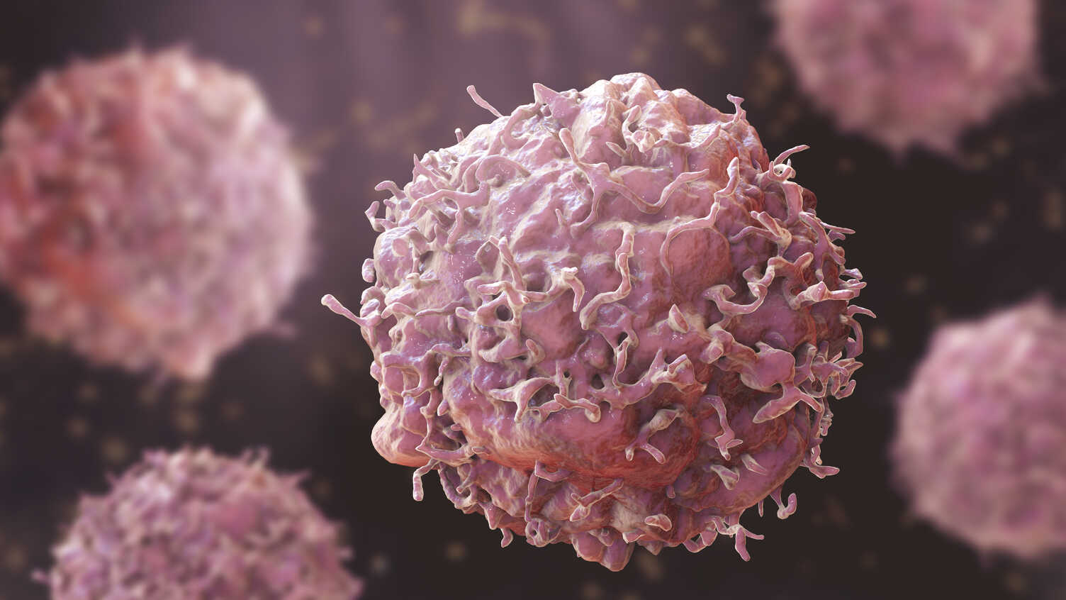 Cutting Cancer's Fuel May Boost Treatment Efficacy