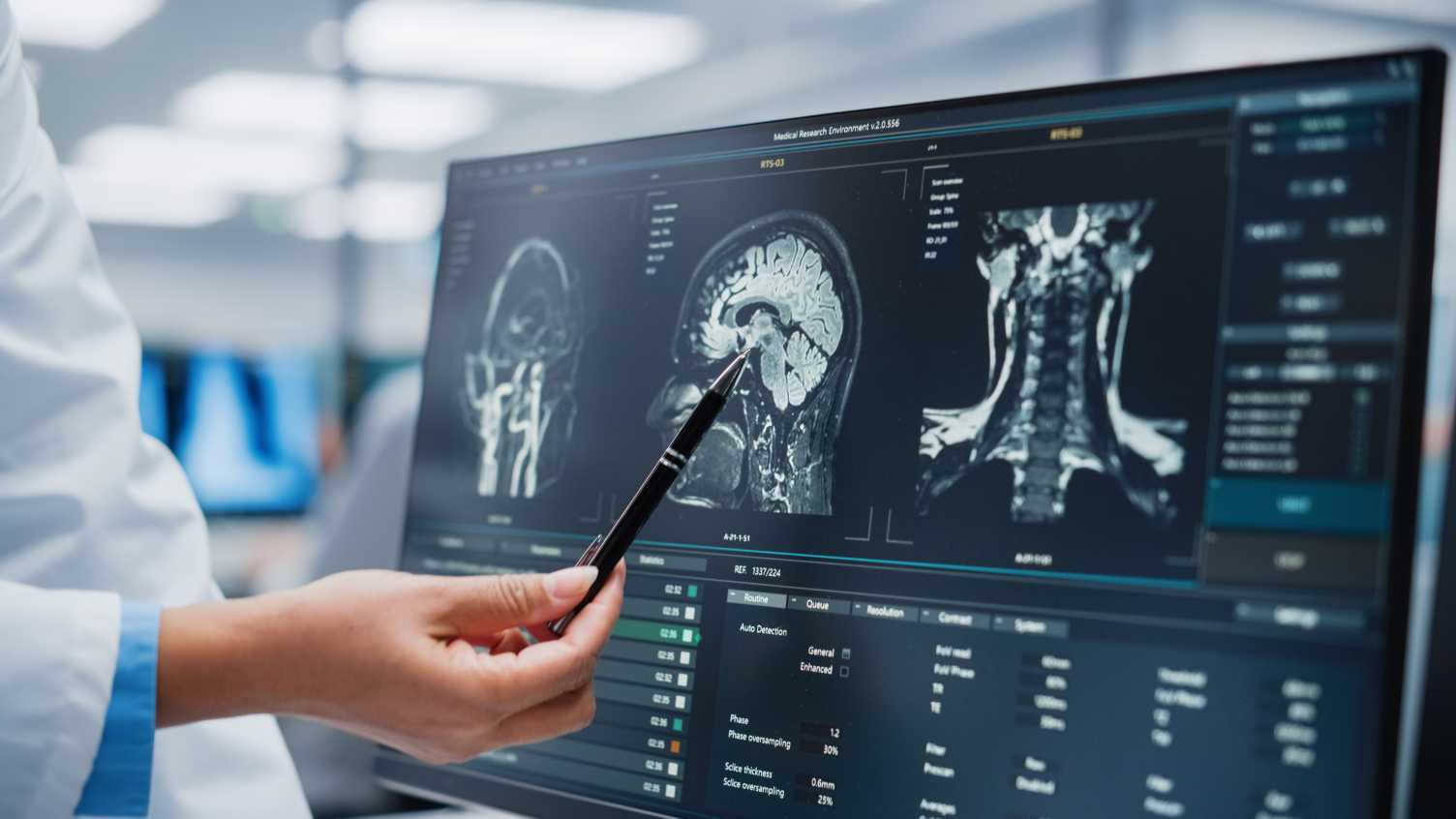 Thumbnail for Lateral flow test to detect recurring aggressive brain tumours | News 
