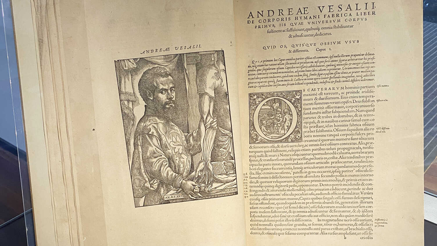Thumbnail for Anatomy at Sheffield exhibition | Library 